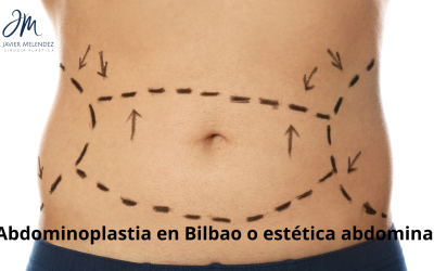 Descubriendo los Tipos de Abdominoplastia: La Guía Completa para tu Transformación