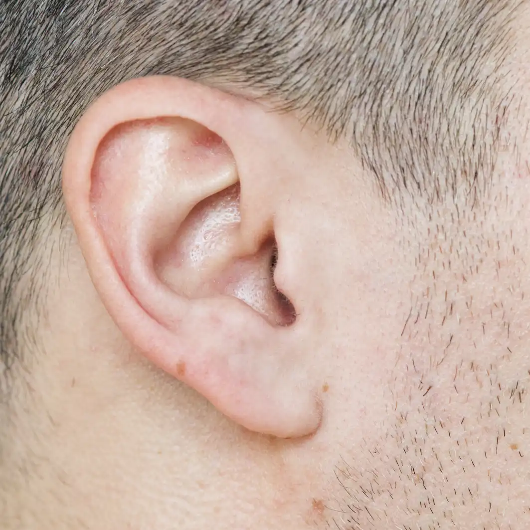 operacion lobulos orejas